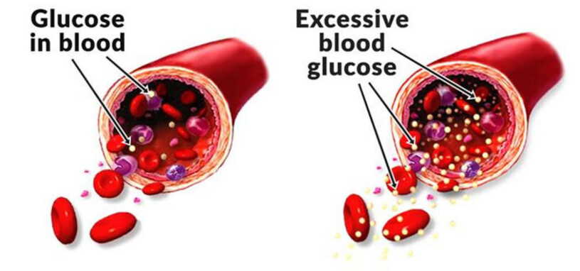 Guardian Botanicals Blood Balance Australia - Updated 2022 (Official) | bulb